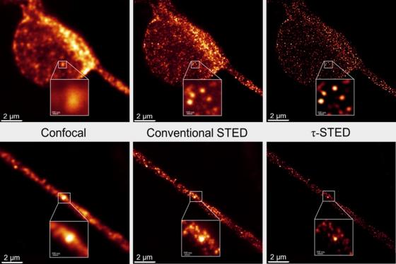 Comparison of Immunofluorescence images of neurons