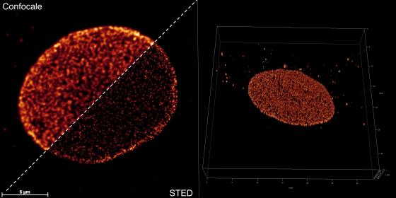 Immagini di pori nucleari (NUP107) da linea cellulare HepG2