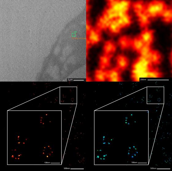 Immagini di pori nucleari (NUP107) da linea cellulare HepG2