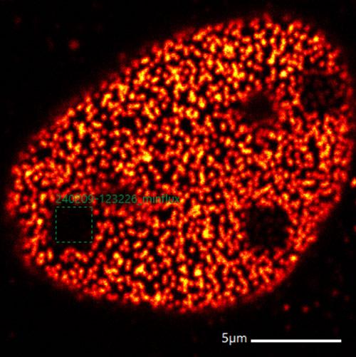 Immagine confocale di pori nucleari (NUP107) da linea cellulare HepG2
